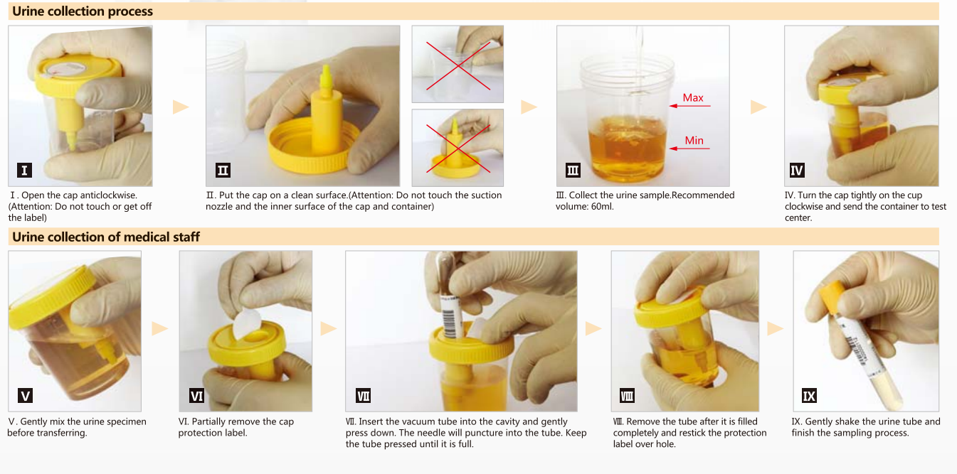 KANGJIAN Vacuum Urine Collector-4.png